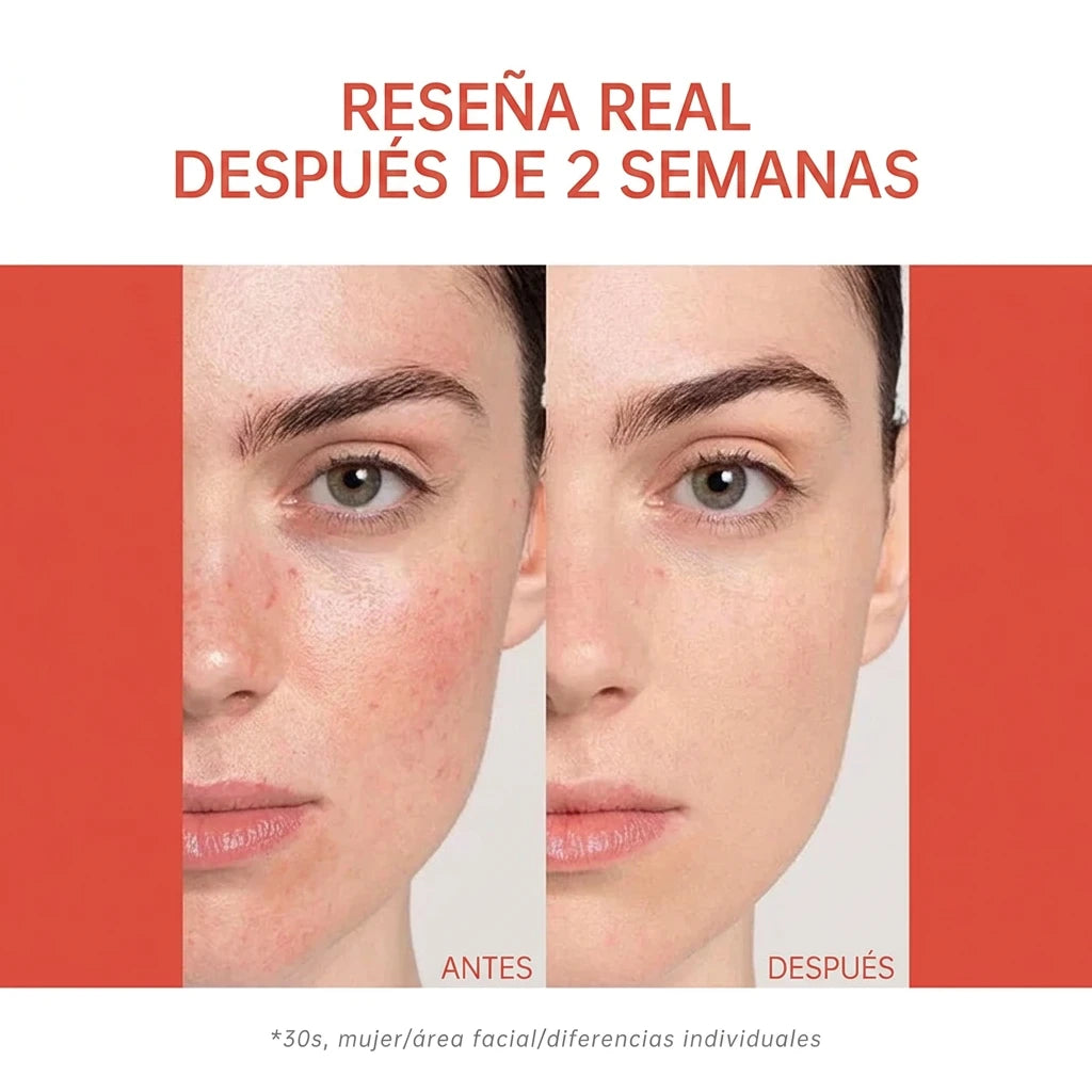 Ampollas faciales PDRN – foto 4
