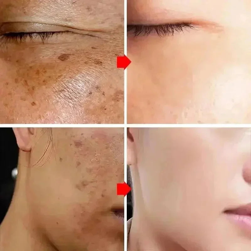 Crema iluminadora para manchas – foto 3