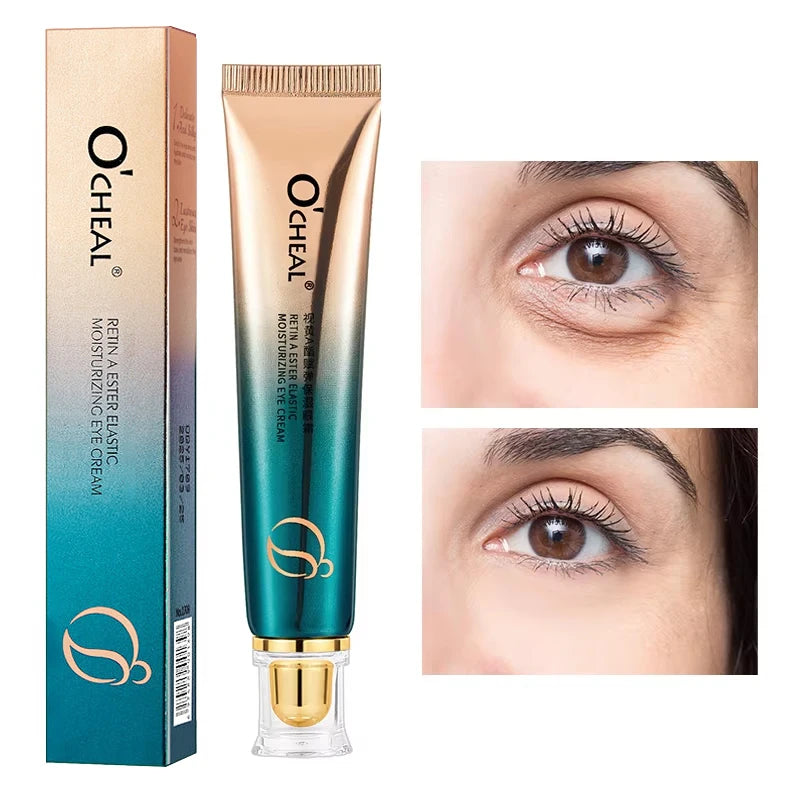 Crema de ojos con retinol 30 g – Aurélie Seoul