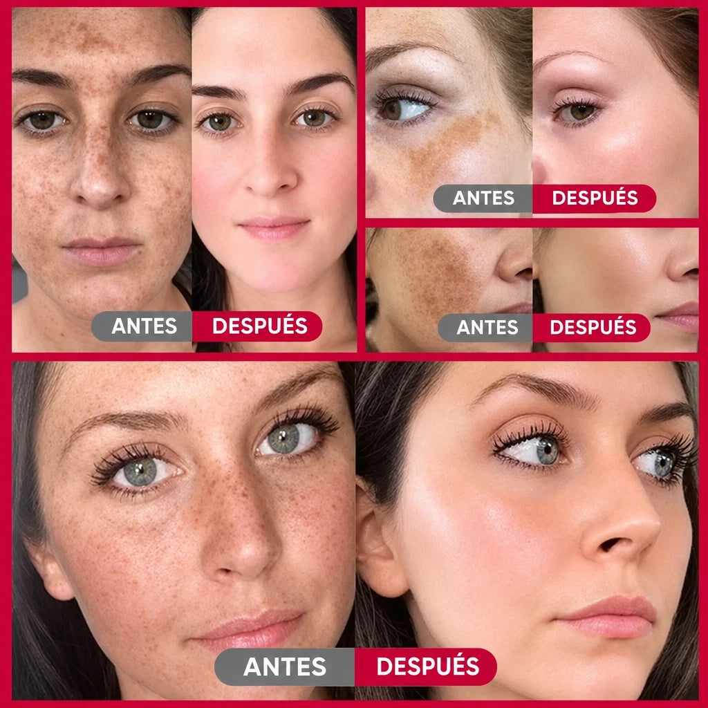 Crema iluminadora para manchas – foto 2